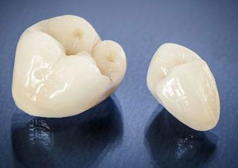 dental crowns